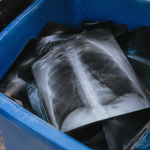 Où jeter les radiographies : trois solutions pour s'en débarrasser Main versant radiographies noires blanches dans bac recyclage